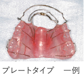 プレートタイプ 一例