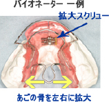 プレートタイプ 一例